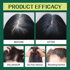 Vendas quentes personalizadas Crescimento do cabelo Hidratante Scalp <span class=keywords><strong>Amla</strong></span> <span class=keywords><strong>Oil</strong></span> Óleo de crescimento do cabelo Orgânico Indian <span class=keywords><strong>Amla</strong></span> Extract Hair Growing <span class=keywords><strong>Oil</strong></span> - Product Image 6