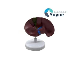 Modèle du Foie et de la Vésicule Biliaire Pathologique - Outil Pédagogique en Hépatologie - Product Image 1
