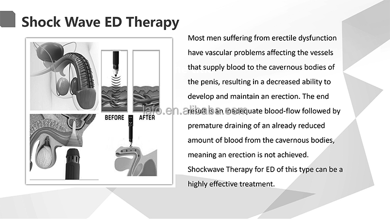 shock wave therapy erectile dysfunction equipment / portable shock wave machine for pain relief