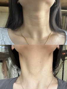 KXY Derma Ampolla Rassodante Collo Effetto Lifting Anti-Età Collagene Idratante - Product Image 4