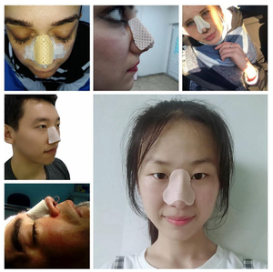 Neuscorrectie Externe Thermoplastische Neus Fractuur Spalk Hoge Kwaliteit Externe Nasale Spalk - Product Image 5