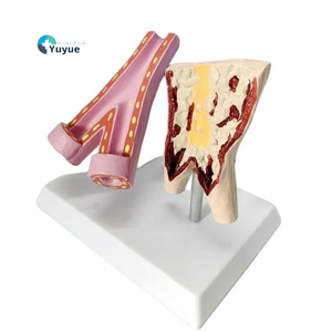 Modelo de Comparación de Vasos Sanguíneos Normales <span class=keywords><strong>y</strong></span> Vasos Dañados por el Tabaco, Estructura Vascular, Enseñanza Anatómica, <span class=keywords><strong>Ciencia</strong></span> Popular - Product Image 1