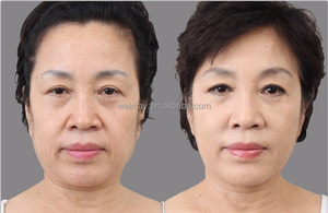 핫 세일 휴대용 스파 살롱 클리닉 사용 바늘 메조 테라피 장치 피부 강화 Electroporation 메조 테라피 기계 - Product Image 6