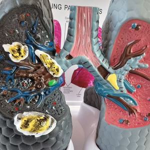 Modelo Anatómico Patológico de Corazón y Pulmón Humano con Imágenes - Medicina - Modelo del Sistema Respiratorio Pulmonar - Product Image 5