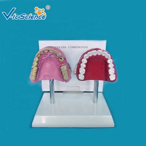 Modelo Comparativo de Dientes de Fumador, Modelo de Exhibición de <span class=keywords><strong>Salud</strong></span> Bucal, Modelo Educativo de Anatomía Dental - Product Image 3