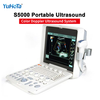 Système de diagnostic vétérinaire numérique à haute fréquence par ultrasons vétérinaire portable pour la détection de grossesse avec imagerie claire en temps réel