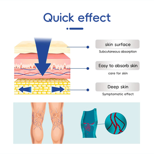 La pression de patchs de varices de qualité médicale pour l'approvisionnement en soins de santé de conception soulage la douleur des jambes favorise un sang plus sain - Product Image 5