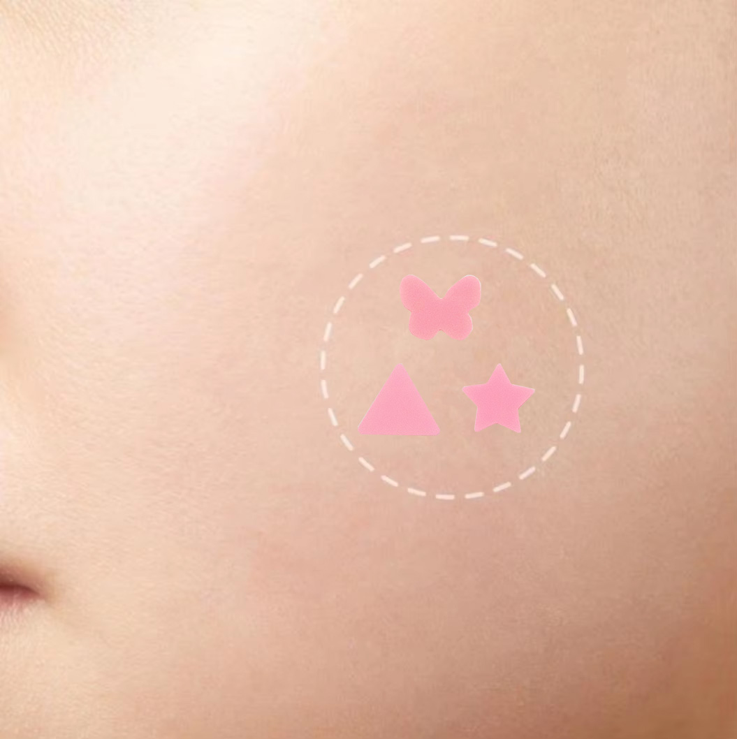 Pink Series Hydrocolloid Acne Paste Invisible Makeup Waterproof Breathable Acne Skin Repair
