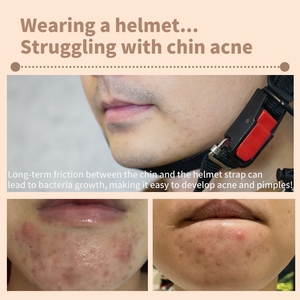 แผ่นรองคางหมวกกันน็อคสำหรับดัดแปลงรถจักรยานยนต์ xilla สีดำสีขาวสีน้ำตาลทองแดง - Product Image 3