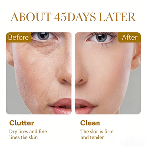 Loción Facial Hidratante y Antiarrugas con Colágeno OEM ODM, 80g, Goma Xantana, Aminoácidos de Serina, Suavizante - Product Image 3