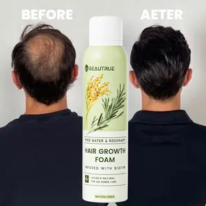 पुरुषों और महिलाओं के लिए लोकप्रिय प्राकृतिक चावल पानी रोज़मेरी तेल बाल विकास फोम बालों को मोटा करने वाला उपचार ग्रोथ मूस