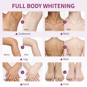 Crème éclaircissante multi-effets pour le visage, atténue les taches brunes, illumine le teint terne, élimine les taches de rousseur, vente en gros - Product Image 6