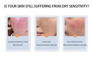 Appareil de beauté multifonctionnel pour soins du visage avec technologie d'oxygène CO2 pour le soin de la peau et une hydratation profonde - Product Image 3