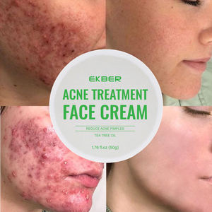 プライベートラベルアンチエイジングクリームリンクルアクネビタミンモイスチャライザーアロエフェイススキンホワイトニングアンチアクネクリーム - Product Image 1