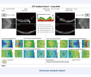 プロ仕様の光干渉トモグラフィOCTマシン - Product Image 3