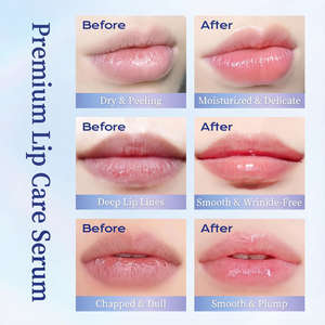 Crema <span class=keywords><strong>de</strong></span> Esencia Labial Vegana Orgánica Antiarrugas LAOLISHI, Hidratante, Nutritiva, Diluye las Líneas <span class=keywords><strong>de</strong></span> los <span class=keywords><strong>Labios</strong></span>, Exfoliante, Otoño Invierno 10g - Product Image 6