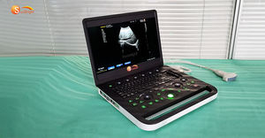 SUN-800C mesin <span class=keywords><strong>Ultrasound</strong></span> portabel 15.6 inci <span class=keywords><strong>Laptop</strong></span>, mesin <span class=keywords><strong>Ultrasound</strong></span> perlengkapan rumah sakit pemindai <span class=keywords><strong>Ultrasound</strong></span> BW PW untuk hewan - Product Image 3