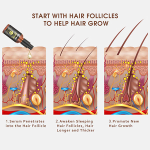 Le traitement à la biotine favorise la stimulation des racines des cheveux Huile essentielle répare le sérum de croissance des cheveux endommagés - Product Image 5