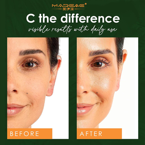 Meilleur sérum de beauté à la vitamine C pour le visage à l'acide hyaluronique éclaircissant ordinaire pour les soins de la peau - Product Image 5