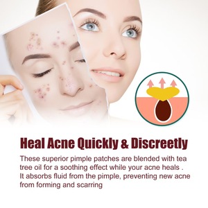 Patchs anti-acné 40 étoiles les plus vendus pour couvrir les imperfections et les boutons du visage - Product Image 2