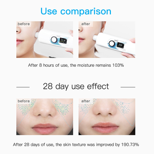 चेहरे का सीरम एंटी-एज हाइलूरोनिक एसिड पोर सिकुड़ते चेहरे सीरम झुर्रियों को कम करने से त्वचा डार्क स्पॉट रिमूवर सीरम उपचार - Product Image 6