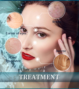 Máquina Facial de Hidrodermoabrasión de Alta Calidad, <span class=keywords><strong>Aqua</strong></span> Jet Peel, Limpieza Facial, Rejuvenecimiento de la Piel - Product Image 6