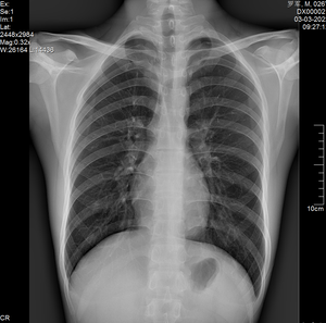 كاشف لوحي مسطح محمول عالي الدقة جديد لعام <span class=keywords><strong>2026</strong></span> - Product Image 5