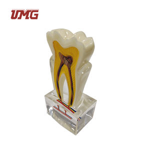 แบบจำลอง<span class=keywords><strong>ฟัน</strong></span><span class=keywords><strong>ฟัน</strong></span>กรามที่มีเส้นประสาท6ครั้ง - Product Image 4