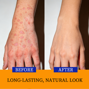 Crema de Alta Calidad para el Cuidado Corporal con Extracto Herbal Natural, Nutritiva y Reparadora para Piel Dañada, Fórmula en Tubo para Piel Sensible y Psoriasis - Product Image 2