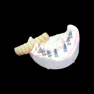 Premium Implantaat-Ondersteunde Prothese | Titanium <span class=keywords><strong>Abutment</strong></span> Met Precisie Zirkonia Kroon Voor Stabiele En Comfortabele Pasvorm - Product Image 5