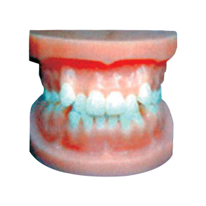 Maniquí de Ciencias Médicas ADA-L1025: Modelo de Dientes para Corregir Deformidades, Muestra Formas Anormales como Dientes Empotrados, Sobremordida, Protrusión y Abertura - Product Image 1