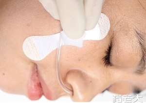 Stiker fiksasi tabung nasoglambung wadah kateter Nonwoven steril sekali pakai - Product Image 4