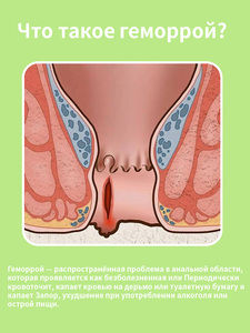 Pommade concentrée à base de plantes Zourunan pour le soin des hémorroïdes 20g Hygiène externe Vente en gros OEM Distributeur de marques privées - Product Image 4