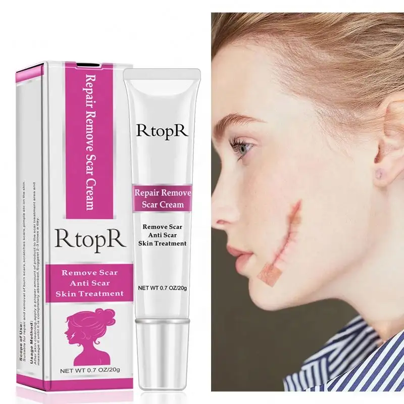 RtopR Repair Remove Scar Skin Treatment Reduces The Appearance Of Old And New Acne Scars Whitening Face Cream