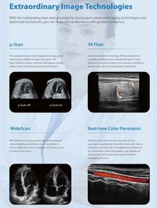 Appareil d'échographie Doppler couleur Sonoscape P11Elite <span class=keywords><strong>4D</strong></span>/5D avec fonction IA, chariot, pour les veines, le bébé, l'abdomen - Product Image 3