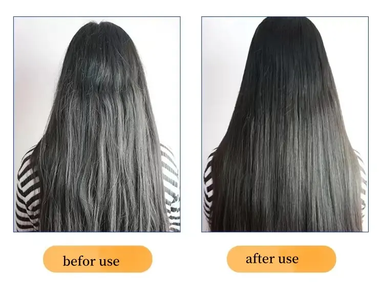 Serum Rambut, minyak perawatan penumbuh rambut, perawatan minyak rambut Keratin Protein