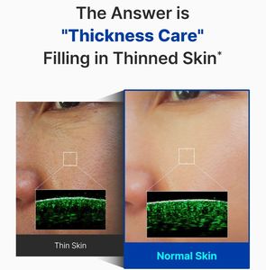 ETRUN ALISA marca privada PDRN crema <span class=keywords><strong>de</strong></span> barrera ultra hidratante aclara las manchas oscuras cura las cicatrices calmar la piel sensible y grasa - Product Image 5