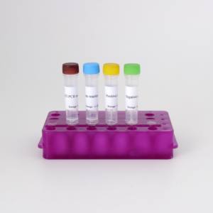 Kit de RT-PCR fluorescente de alta sensibilidad para la detección del virus de la encefalitis equina venezolana - Product Image 2