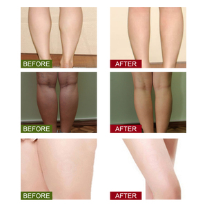 Ymphatic rainage-remate de roble, - Product Image 3