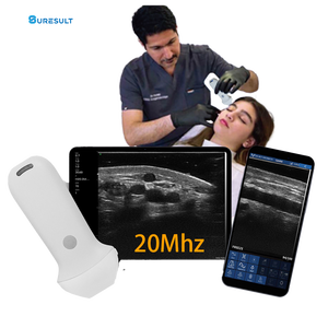 Alat genggam estetis 20MHz wajah, dengan dukungan Doppler warna <span class=keywords><strong>DICOM</strong></span> untuk prosedur estetika Clarius L20 - Product Image 1