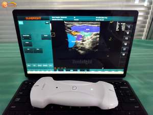 Escáner de Ultrasonido de Bolsillo Inalámbrico CE SUN-D7, Sonda 3 en 1, Portátil, a Color, con Doble Cabezal <span class=keywords><strong>Doppler</strong></span> - Product Image 5