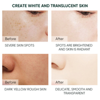 Crème de soin de la peau du fabricant AHA blanchissant l'élimination des taches de rousseur Melasma taches brunes dissolvant de mélanine la perle de niacinamide éclaircit la peau