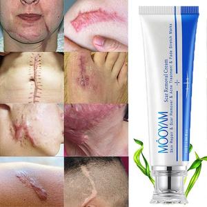 Crème avancée <span class=keywords><strong>pour</strong></span> <span class=keywords><strong>pommade</strong></span> de cicatrice Amélioration visible en 4 semaines Réduit la profondeur et la décoloration des cicatrices - Product Image 1