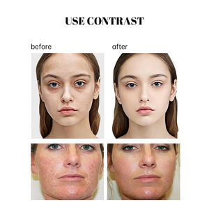 10% Niacinamida + 1% Suero facial de zinc con ingredientes de vitamina <span class=keywords><strong>C</strong></span> y ácido hialurónico - Product Image 4