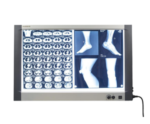 Visualiseur de films médicaux LED simple, double, triple, quadruple, adapté à l'affichage de tous les formats de films radiographiques - Product Image 2