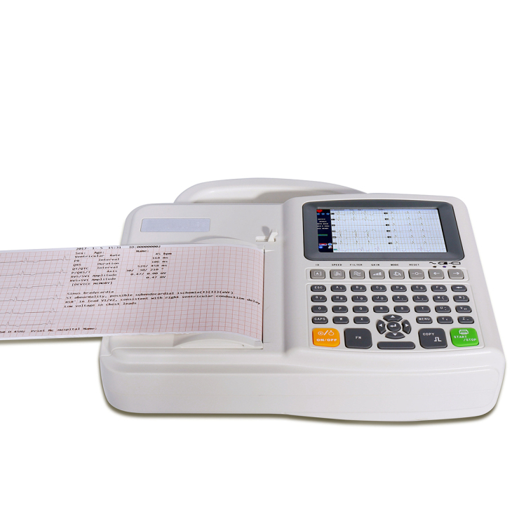 Equipo médico portátil aprobado por CE con interfaz USB, máquina de ECG de 12 derivaciones y 6 canales con interpretación