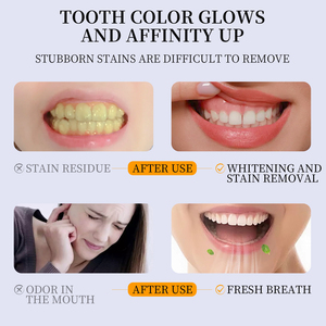Pasta Dental con Hidroxiapatita: Blanqueamiento, Cuidado para <span class=keywords><strong>Dientes</strong></span> y Encías Sensibles, Protección Contra Caries, Control del <span class=keywords><strong>Sarro</strong></span>, Aliento Fresco, Eliminación <span class=keywords><strong>de</strong></span> Manchas - Product Image 3