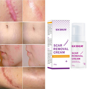 EKBER Crema Riparatrice Naturale Vegana per Danni Cutanei, Rimozione Cicatrici da Acne, Etichetta Privata - Product Image 1