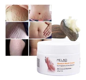 OEM/ODM Private Label Pure Body Moisturizing Removal Belly Cream Stretch Mark Cream For Pregnant Body