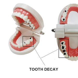 نموذج تعليمي لرعاية الأسنان، معدات تعليمية للمدارس، نموذج تشريحي للعلوم الطبية، نماذج تعليمية لتفاصيل الهياكل التشريحية من يولين - Product Image 3
